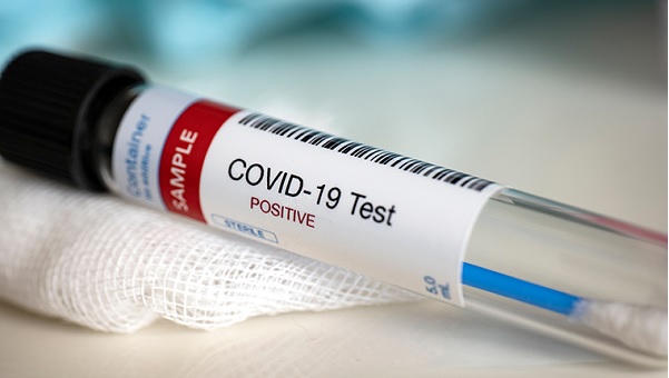 Covid testing centers